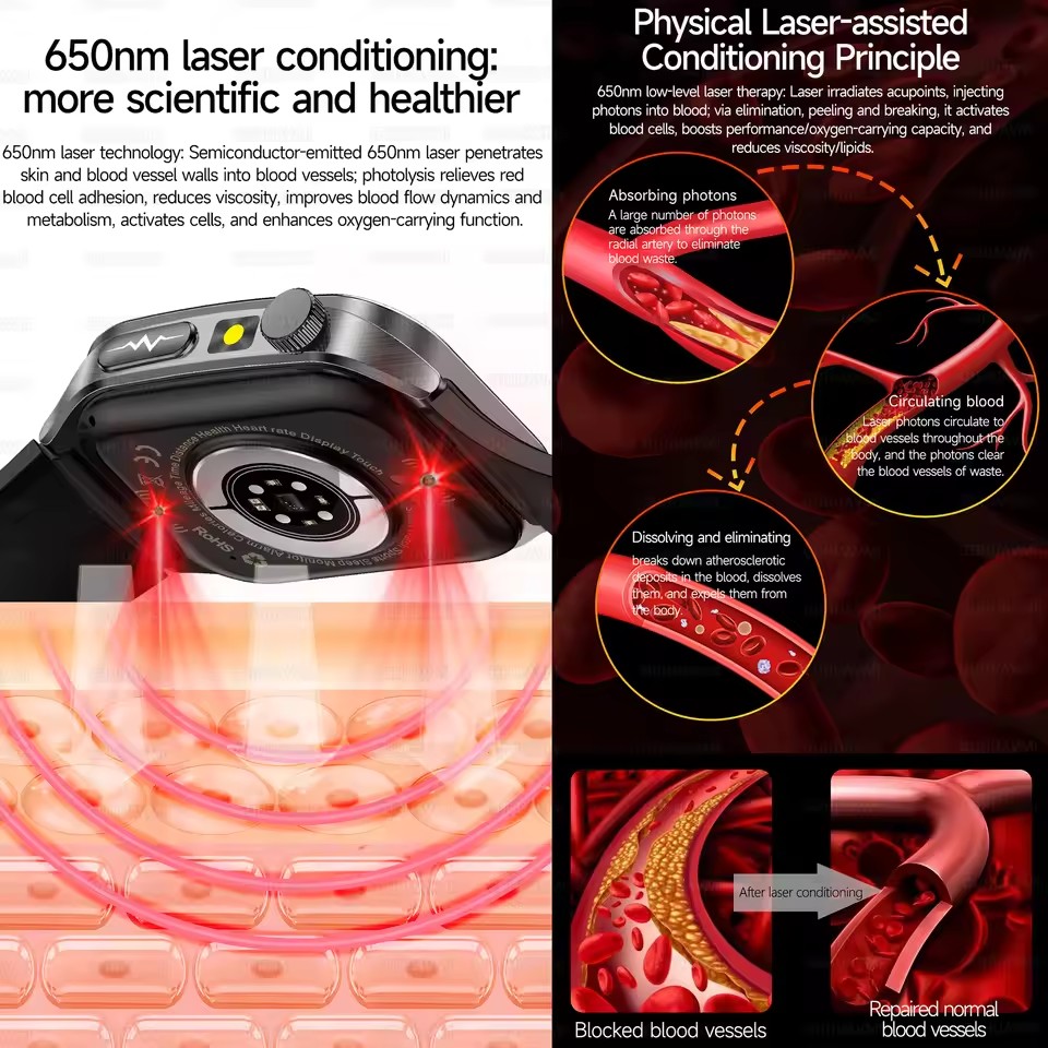 2026 Новые умные часы для здор – обзор и цена Industrial Laser Beam